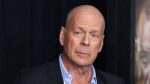 Bruce Willis didiagnosis aphasia